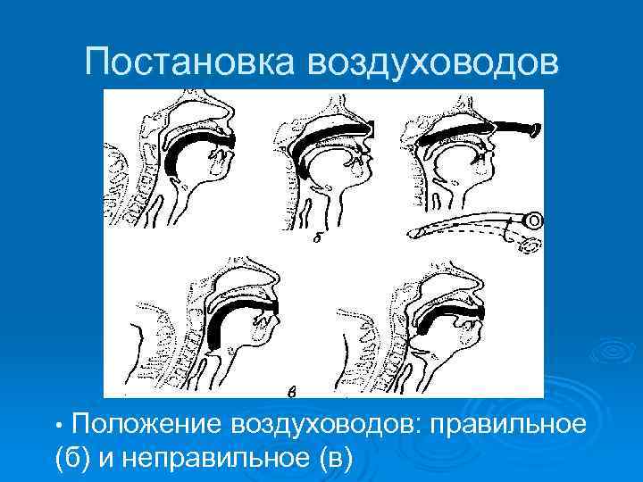 Постановка воздуховодов Положение воздуховодов: правильное (б) и неправильное (в) • 