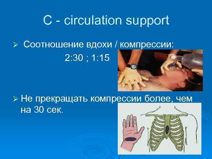 С - circulation support Ø Соотношение вдохи / компрессии: 2: 30 ; 1: 15