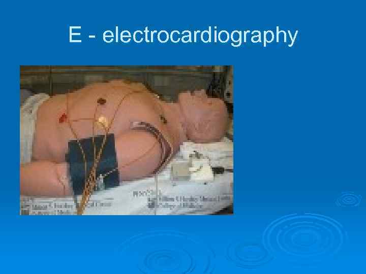 E - electrocardiography 