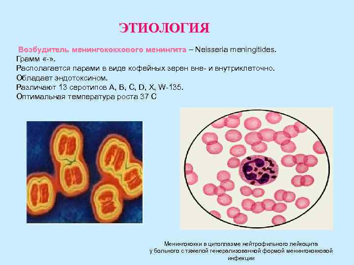 ЭТИОЛОГИЯ Возбудитель менингококкового менингита – Neisseria meningitides. менингита Грамм «-» . Располагается парами в