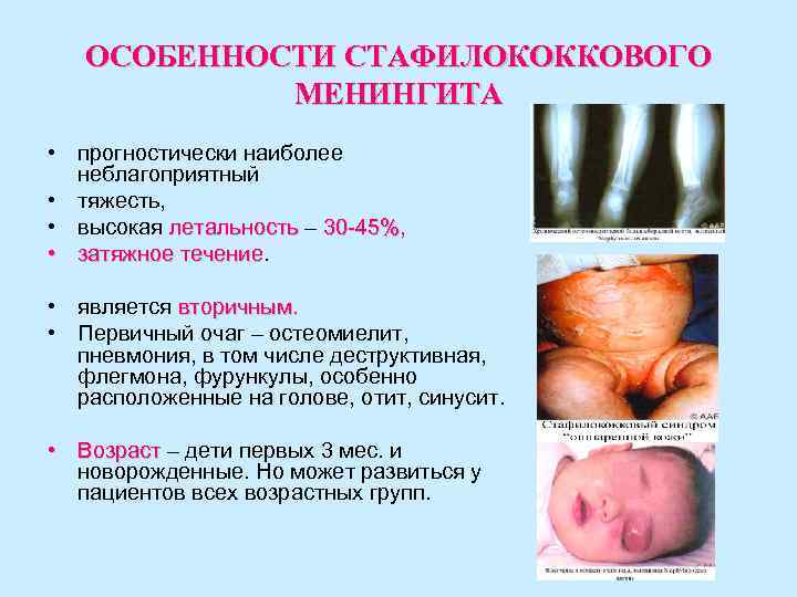 ОСОБЕННОСТИ СТАФИЛОКОККОВОГО МЕНИНГИТА • прогностически наиболее неблагоприятный • тяжесть, • высокая летальность – 30