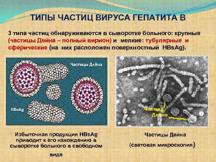 ТИПЫ ЧАСТИЦ ВИРУСА ГЕПАТИТА В 3 типа частиц обнаруживаются в сыворотке больного: крупные (частицы