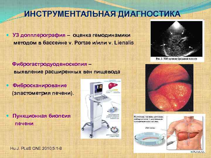 ИНСТРУМЕНТАЛЬНАЯ ДИАГНОСТИКА УЗ допплерография – оценка гемодинамики методом в бассейне v. Portae и/или v.