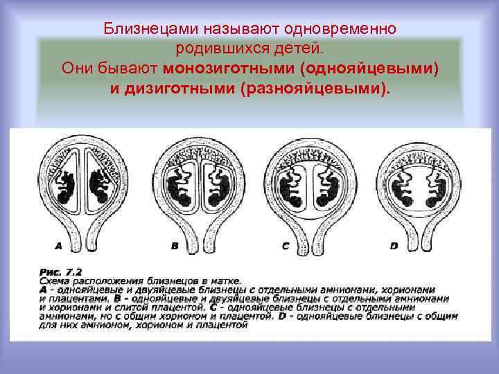 Близнецами называют одновременно родившихся детей. Они бывают монозиготными (однояйцевыми) и дизиготными (разнояйцевыми). 