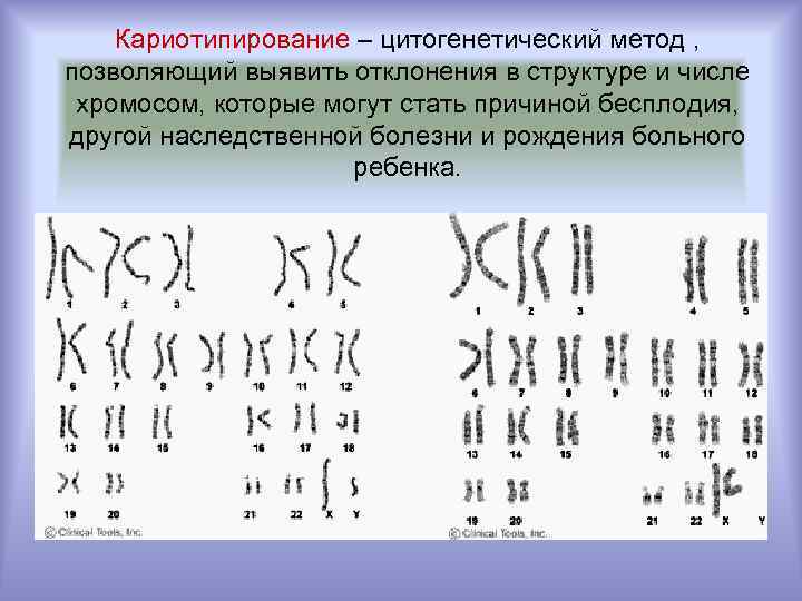 Кариотипирование – цитогенетический метод , позволяющий выявить отклонения в структуре и числе хромосом, которые