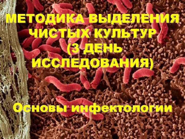 МЕТОДИКА ВЫДЕЛЕНИЯ ЧИСТЫХ КУЛЬТУР (3 ДЕНЬ ИССЛЕДОВАНИЯ) Основы инфектологии 