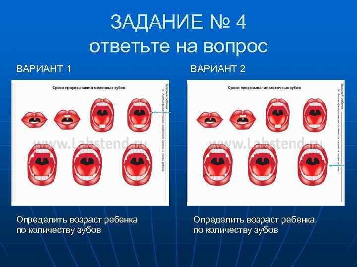 ЗАДАНИЕ № 4 ответьте на вопрос ВАРИАНТ 1 ВАРИАНТ 2  Определить возраст ребенка