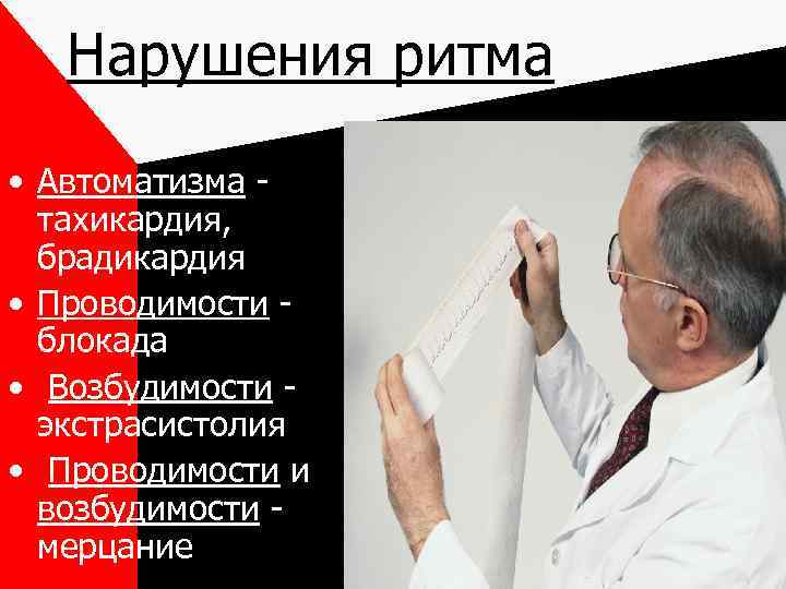 Нарушения ритма • Автоматизма тахикардия, брадикардия • Проводимости блокада • Возбудимости экстрасистолия • Проводимости