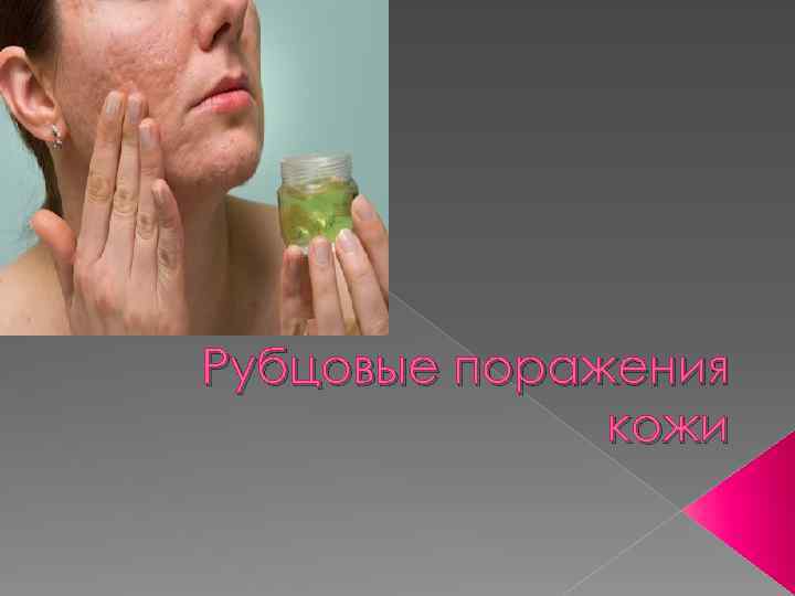 Рубцовые поражения кожи 