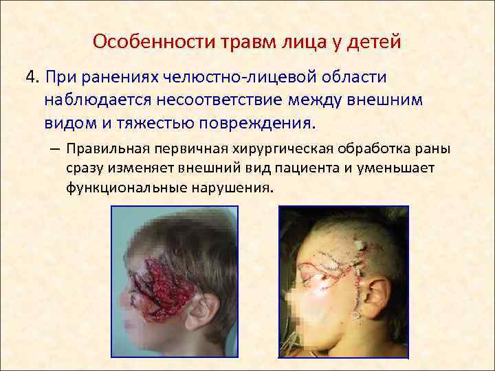 Особенности травм лица у детей 4. При ранениях челюстно-лицевой области наблюдается несоответствие между внешним