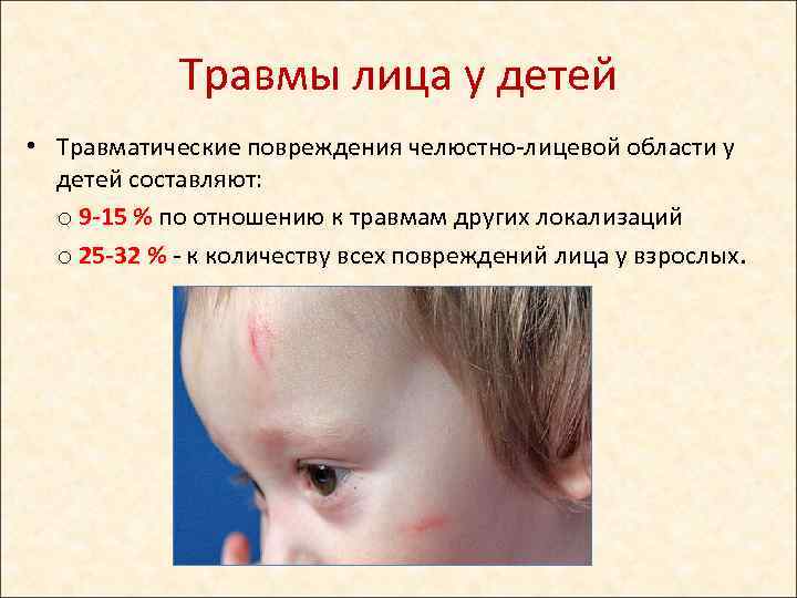 Травмы лица у детей • Травматические повреждения челюстно-лицевой области у детей составляют: o 9
