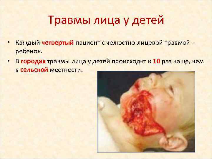 Травмы лица у детей • Каждый четвертый пациент с челюстно-лицевой травмой - ребенок. •