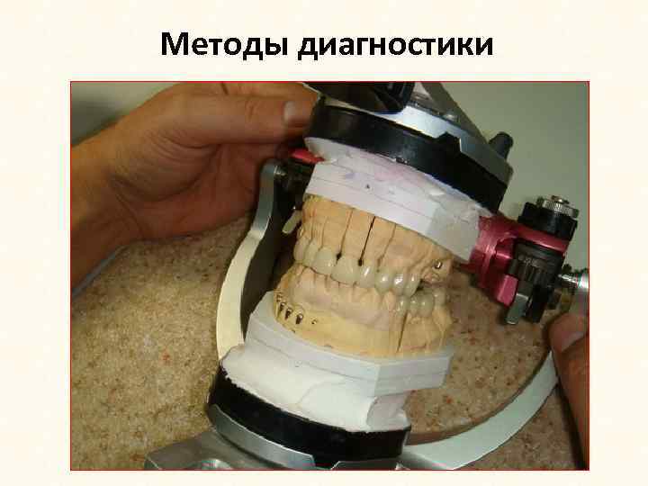 Методы диагностики 