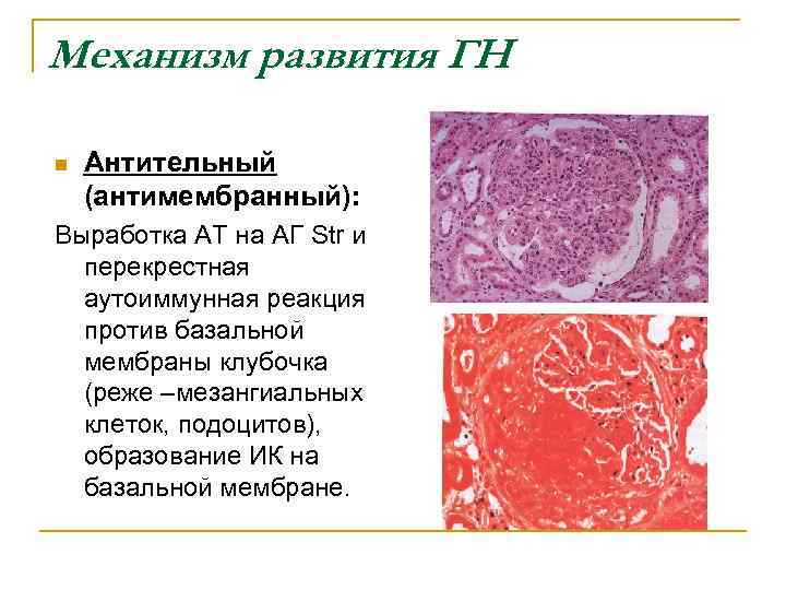 Базальная мембрана клубочка. Базальная мембрана клубочка гистология. Мезангиальные клетки почек. Мезангиальные клетки почечного тельца.