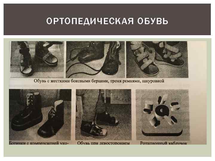 ОРТОПЕДИЧЕСКАЯ ОБУВЬ 