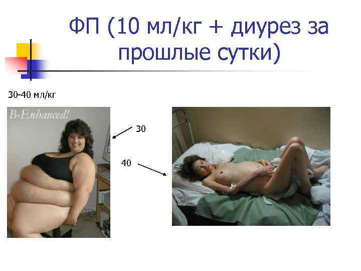 ФП (10 мл/кг + диурез за прошлые сутки) 30 -40 мл/кг 30 40 