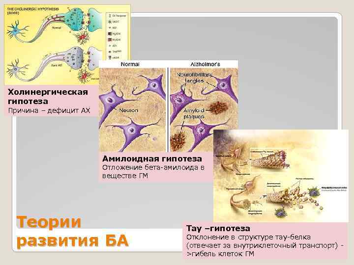 Холинергическая гипотеза Причина – дефицит АХ Амилоидная гипотеза Отложение бета-амилоида в веществе ГМ Теории