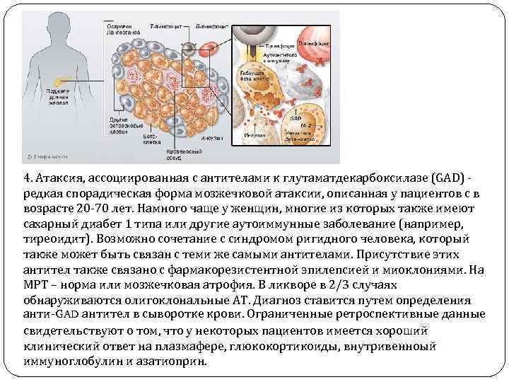 4. Атаксия, ассоциированная с антителами к глутаматдекарбоксилазе (GAD) редкая спорадическая форма мозжечковой атаксии, описанная
