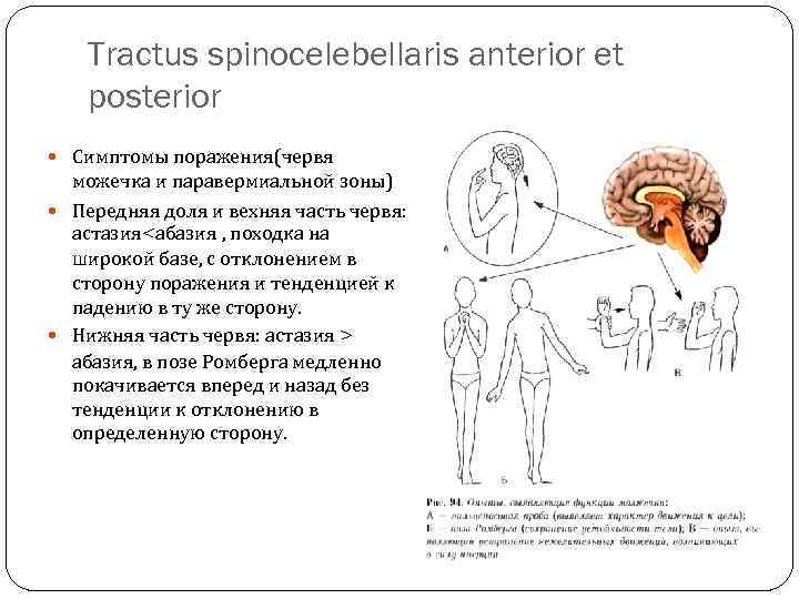 Tractus spinocelebellaris anterior et posterior Симптомы поражения(червя можечка и паравермиальной зоны) Передняя доля и