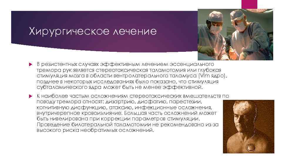 Хирургическое лечение В резистентных случаях эффективным лечением эссенциального тремора рук является стереотаксическая таламотомия или