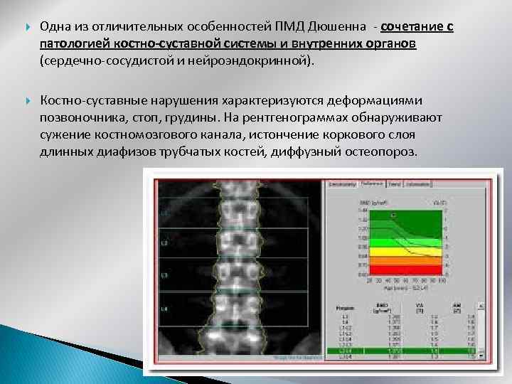  Одна из отличительных особенностей ПМД Дюшенна - сочетание с патологией костно-суставной системы и