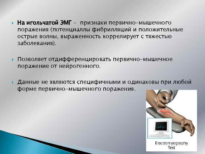  На игольчатой ЭМГ – признаки первично-мышечного поражения (потенциаллы фибрилляций и положительные острые волны,