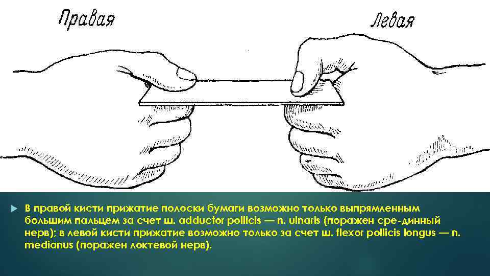  В правой кисти прижатие полоски бумаги возможно только выпрямленным большим пальцем за счет