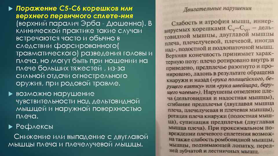 Поражение С 5 C 6 корешков или верхнего первичного сплете ния (верхний паралич Эрба