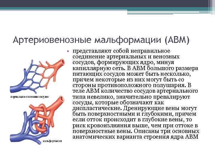 Артериовенозные мальформации (АВМ) • представляют собой неправильное соединение артериальных и венозных сосудов, формирующих ядро,