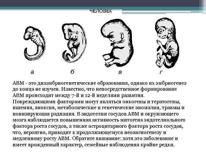 АВМ - это дизэмбриогенетические образования, однако их эмбриогенез до конца не изучен. Известно, что