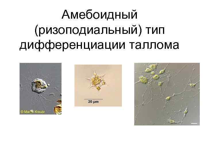 Амебоидный (ризоподиальный) тип дифференциации таллома 
