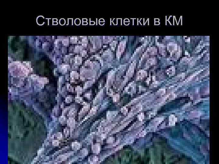 Стволовые клетки в КМ 