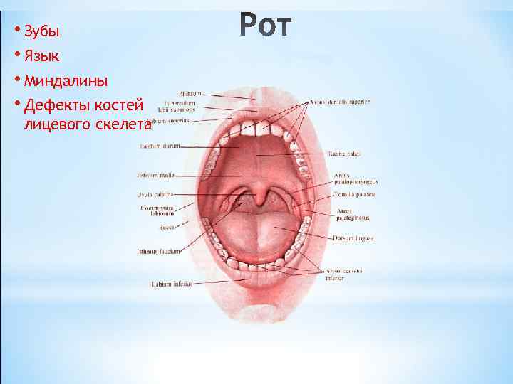  • Зубы • Язык • Миндалины • Дефекты костей лицевого скелета 