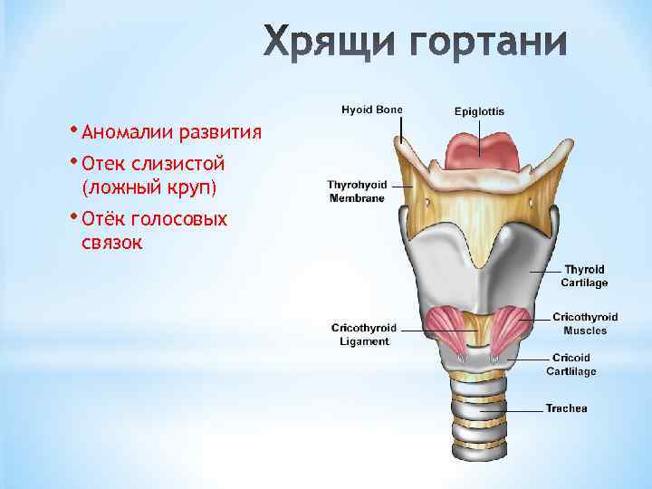  • Аномалии развития • Отек слизистой (ложный круп) • Отёк голосовых связок 