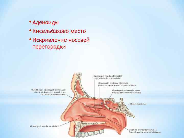  • Аденоиды • Кисельбахово место • Искривление носовой перегородки 