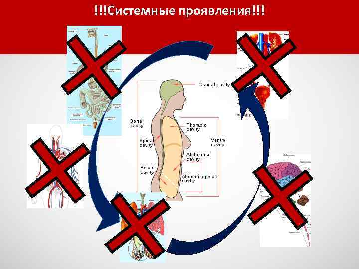 !!!Системные проявления!!! 