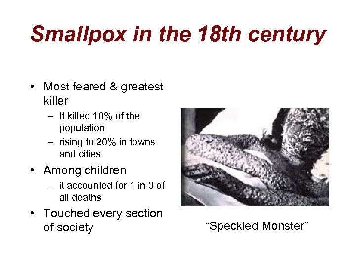 Smallpox in the 18 th century • Most feared & greatest killer – It