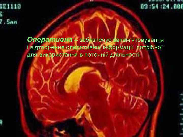 Оперативна – забезпечує запам’ятовування і відтворення оперативної інформації, потрібної для використання в поточній діяльності.