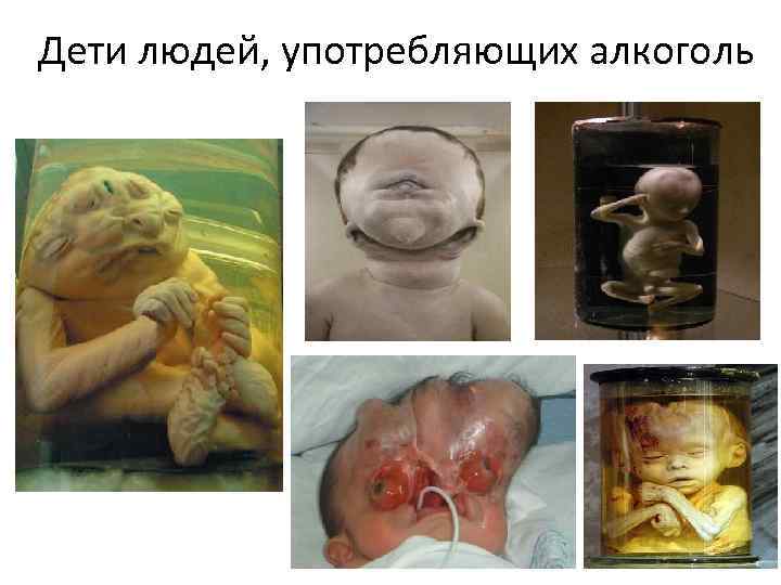 Дети людей, употребляющих алкоголь 