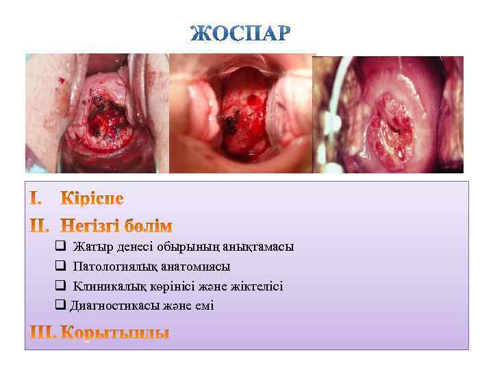 q Жатыр денесі обырының анықтамасы q Патологиялық анатомиясы q Клиникалық көрінісі және жіктелісі q