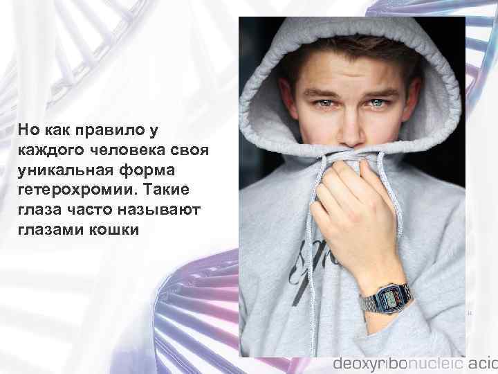 Но как правило у каждого человека своя уникальная форма гетерохромии. Такие глаза часто называют