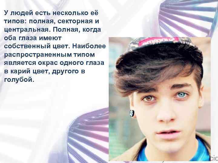 У людей есть несколько её типов: полная, секторная и центральная. Полная, когда оба глаза