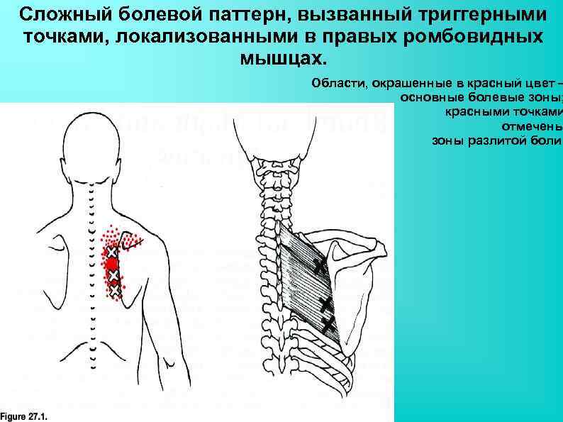 Ушиб нижней части спины и таза карта вызова