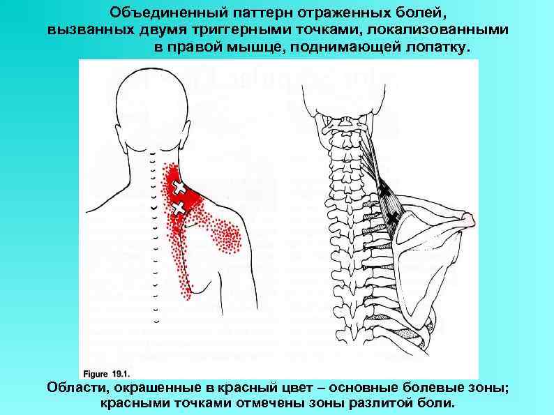 Мышца поднимающая лопатку фото