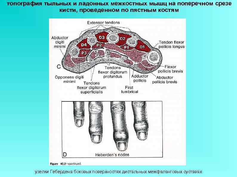 топография тыльных и ладонных межкостных мышц на поперечном срезе кисти, проведенном по пястным костям