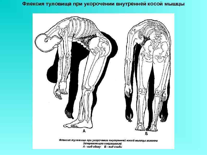 Флексия туловища при укорочении внутренней косой мышцы 