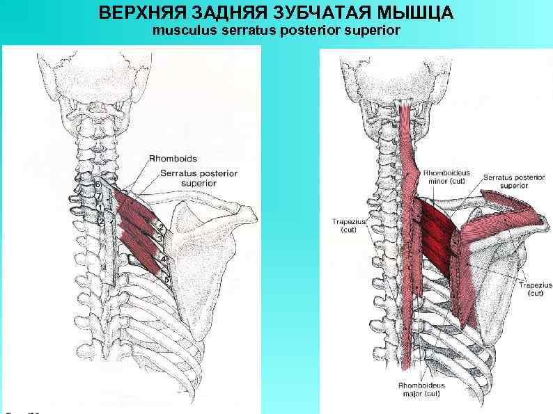 ВЕРХНЯЯ ЗАДНЯЯ ЗУБЧАТАЯ МЫШЦА musculus serratus posterior superior 