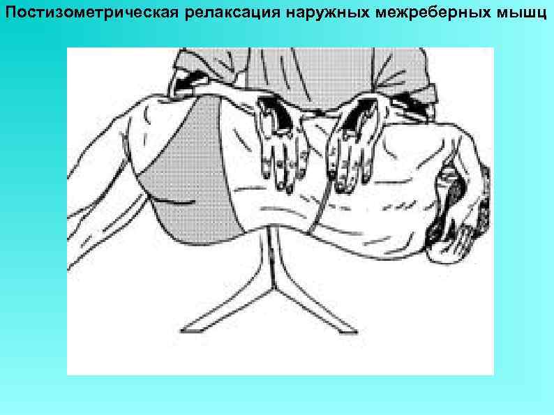 Постизометрическая релаксация наружных межреберных мышц 