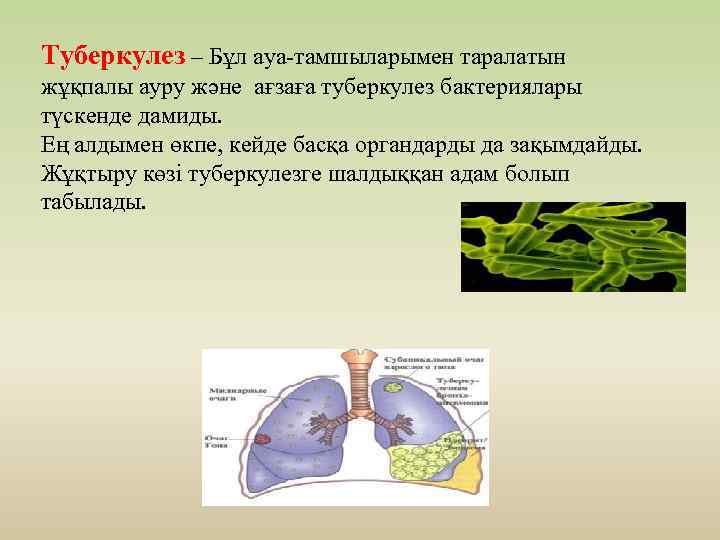 Туберкулез казакша презентация