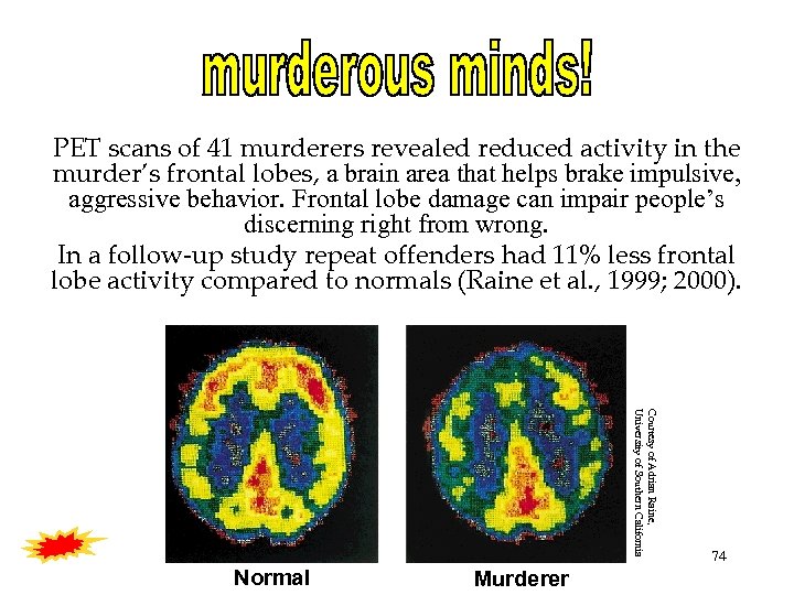 PET scans of 41 murderers revealed reduced activity in the murder’s frontal lobes, a